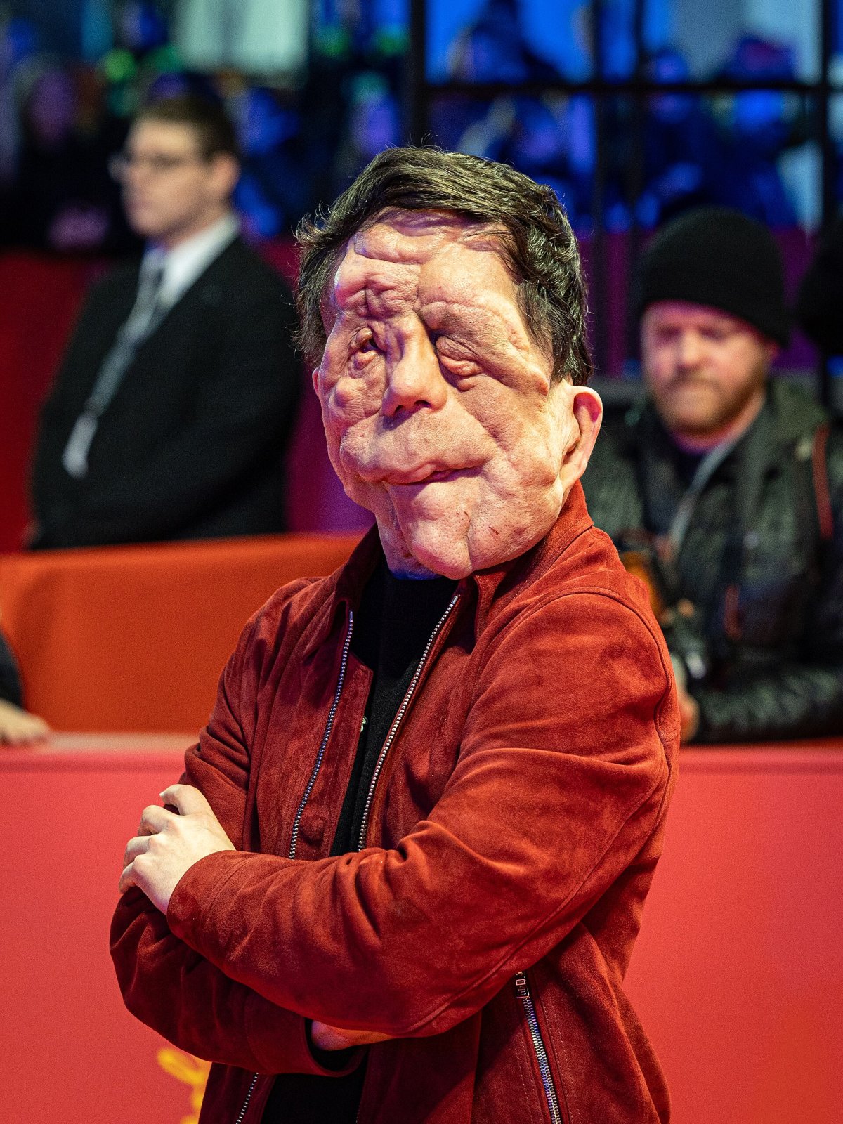 From bullying to acclaim: Adam Pearson's journey