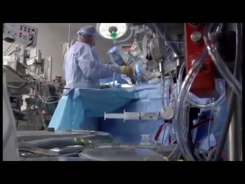 Robotic Finger Innovation Revolutionizes Prostate Exams for Early Detection