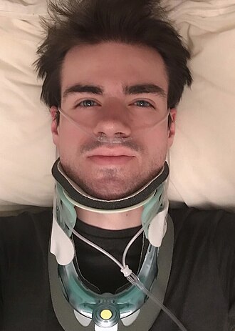 Girl’s Paralysis to Psychology Degree: Inspiring Spinal Injury Advocacy